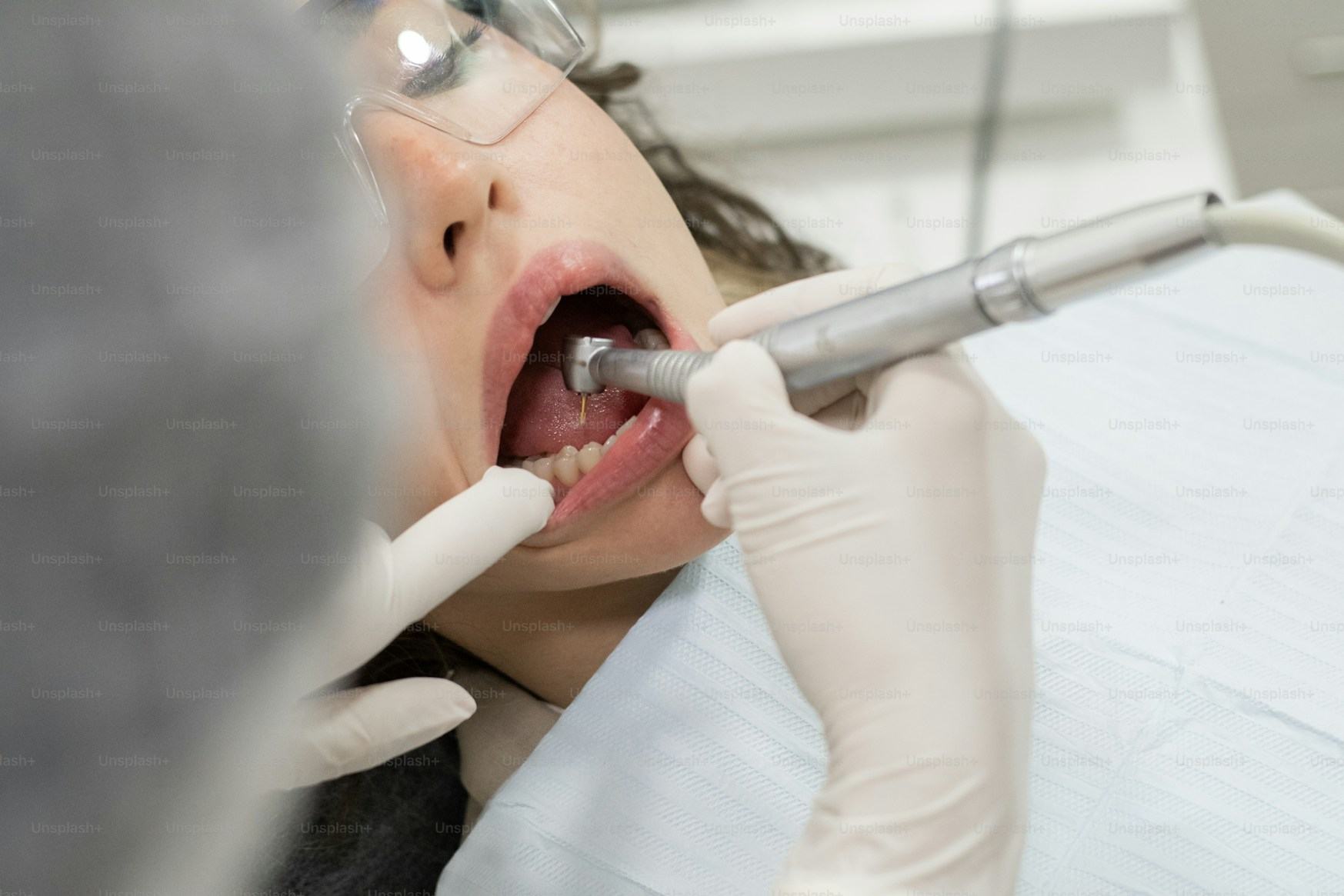 Intervention de chirurgie orale